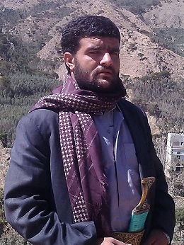 الميليشيات الانقلابية تقتل المواطن محمد القاز بتهمة عودته من صفوف المقاومة الشعبية بمأرب 