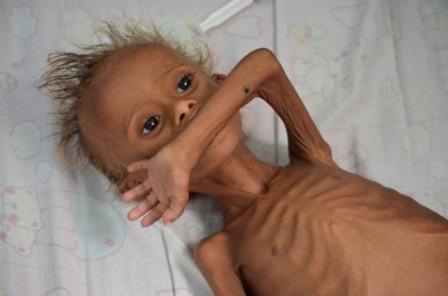 مركز اقتصادي يحذر من مؤشرات مجاعة حقيقة تجتاج عدد من المديرات الفقيرة في اليمن