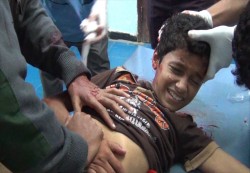 استشهاد 6 مدنيين وإصابة آخرين جراء قصف مدفعي للمليشيات الانقلابية على حي سكني بتعز 