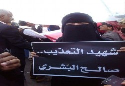 ناشطة حقوقية تتعرض للاعتداء بالضرب من مسلحين وسط العاصمة صنعاء 