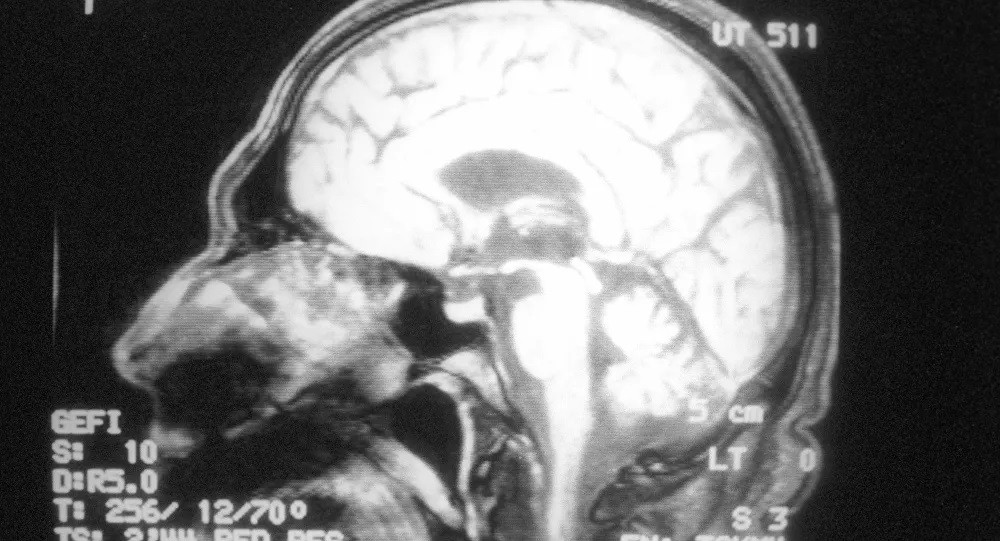 دراسة تكشف عن تأثير لكورونا على الدماغ يستمر لأشهر