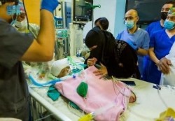 وفاة أحد التوأم اليمني السيامي بعد ساعات من إجراء عملية فصلهما في أحد مشافي السعودية
