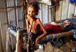أوكسفام تحذر من مجاعة شديدة في اليمن بسبب ارتفاع أسعار المواد الغذائية