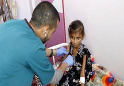أمراض سوء التغذية تهدد الاقتصاد اليمني بخسارة 265 مليون دولار سنوياً
