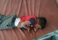 مقتل طفلين بهجوم حوثي على مدرسة شمالي اليمن