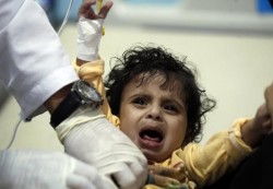 يونيسيف: وفاة 15 طفلاً يمنياً واصابة 1400آخرين بمرض الحصبة خلال 7 أشهر