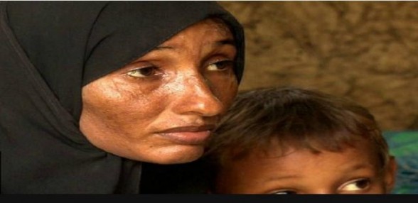 دراسة: اليمن قد يصبح أزمة منسيّة