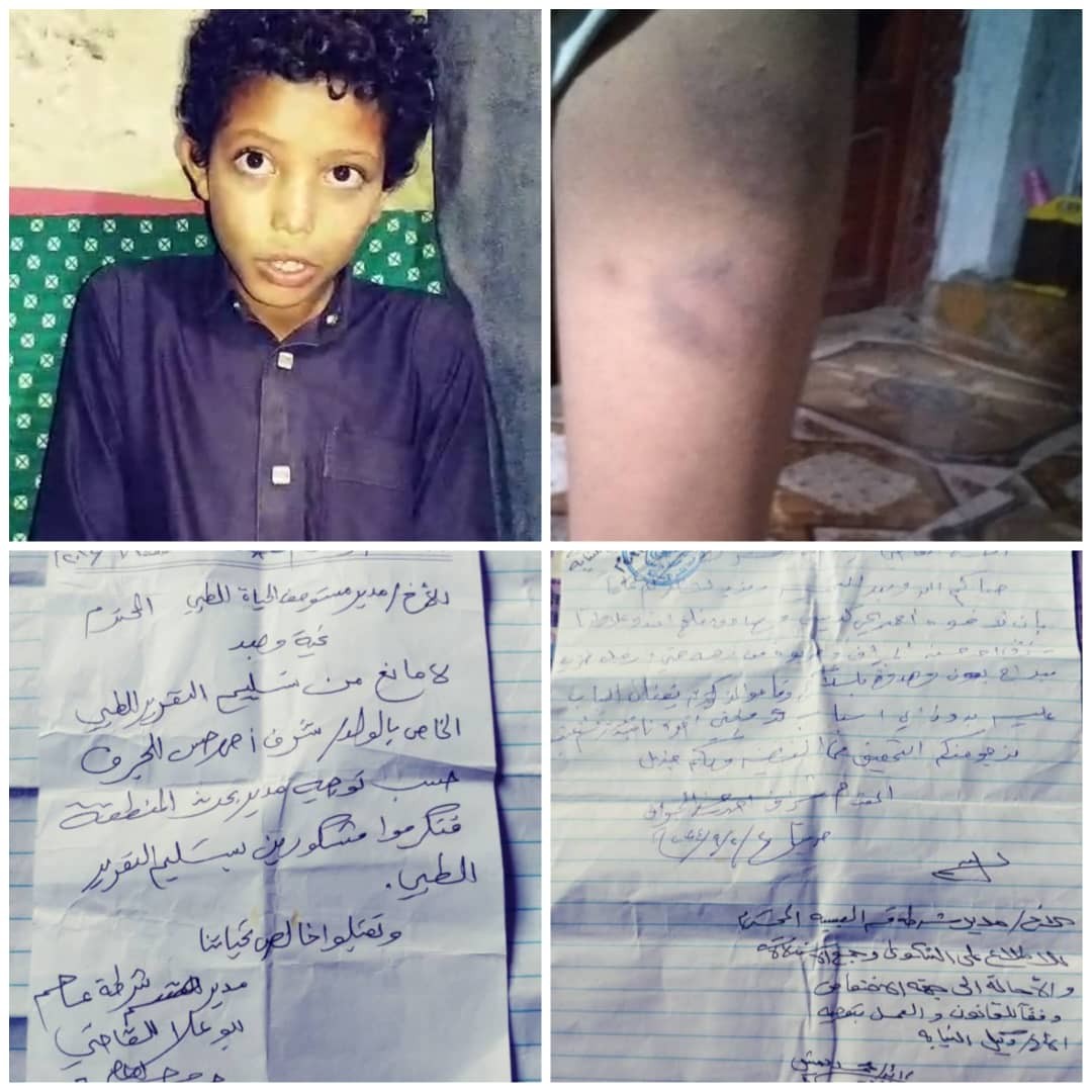 تحت تهديد السلاح: معلمون يعذبون طفلاً في إحدى مدارس حجة
