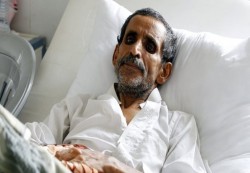 تعز: 20 حالة وفاة ونحو 10 آلاف إصابة بالحصبة والكوليرا والحمى منذ مطلع العام