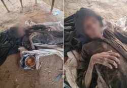 أسابيع فرقت بينهما.. قصة عائلة يمنية قتلها الجوع والمرض