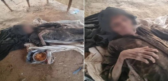 أسابيع فرقت بينهما.. قصة عائلة يمنية قتلها الجوع والمرض